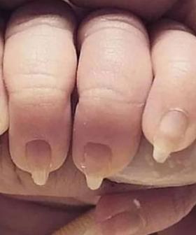 The Internet Is Up In Arms Over This "Trashy" Photo Of A Baby's Fingernails