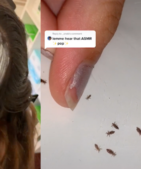 People Have Become Obsessed With Lice Popping Thanks To This Sydney Woman